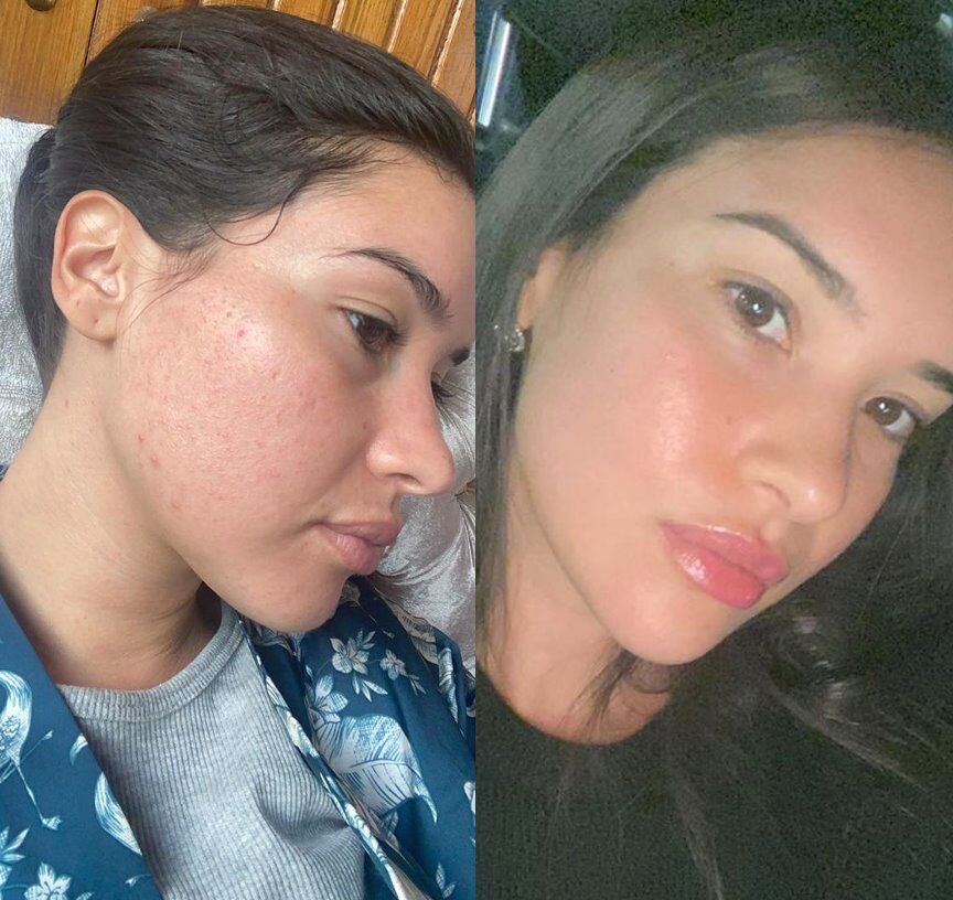 Routine Hydra+ thumbnail 4