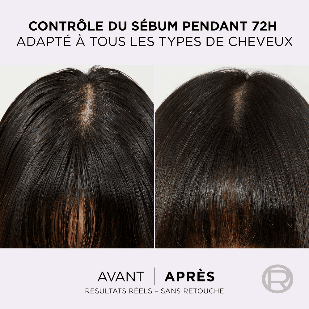 ELSEVE APRÈS SHAMPOING 200ML HYALURON PURE thumbnail 4