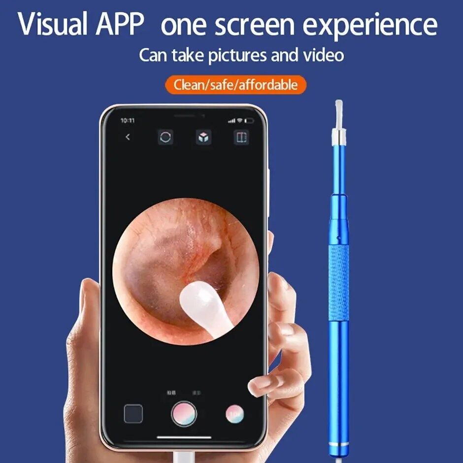 Outil De Nettoyage D’oreille Intelligent Avec Mini Caméra Endoscope thumbnail 1