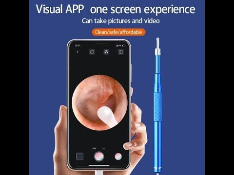 Outil De Nettoyage D’oreille Intelligent Avec Mini Caméra Endoscope thumbnail 4
