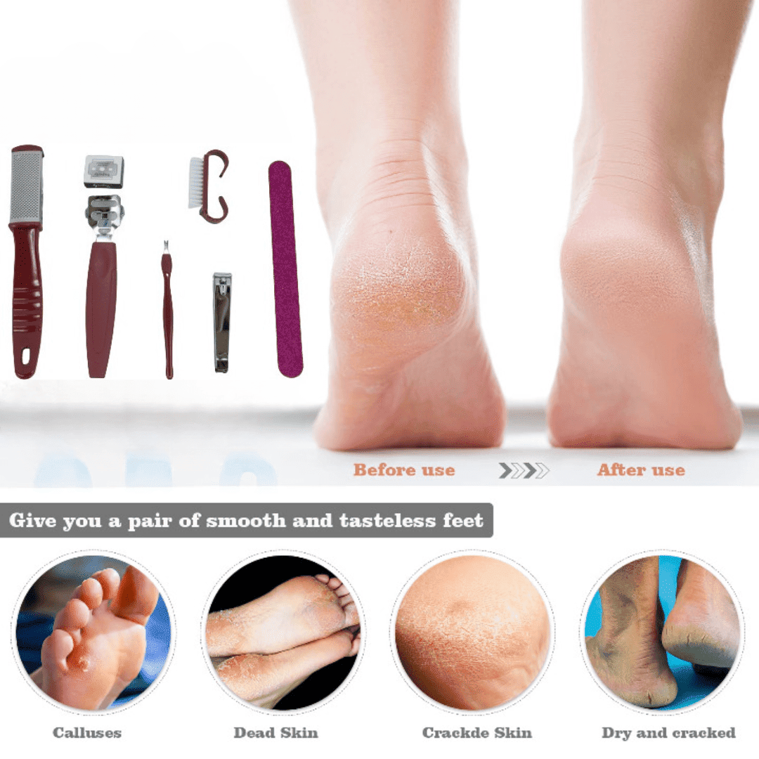 Kit pédicure 7 pièces en acier inoxydable pour soins des pieds féminins (colleur aléatoire) thumbnail 3