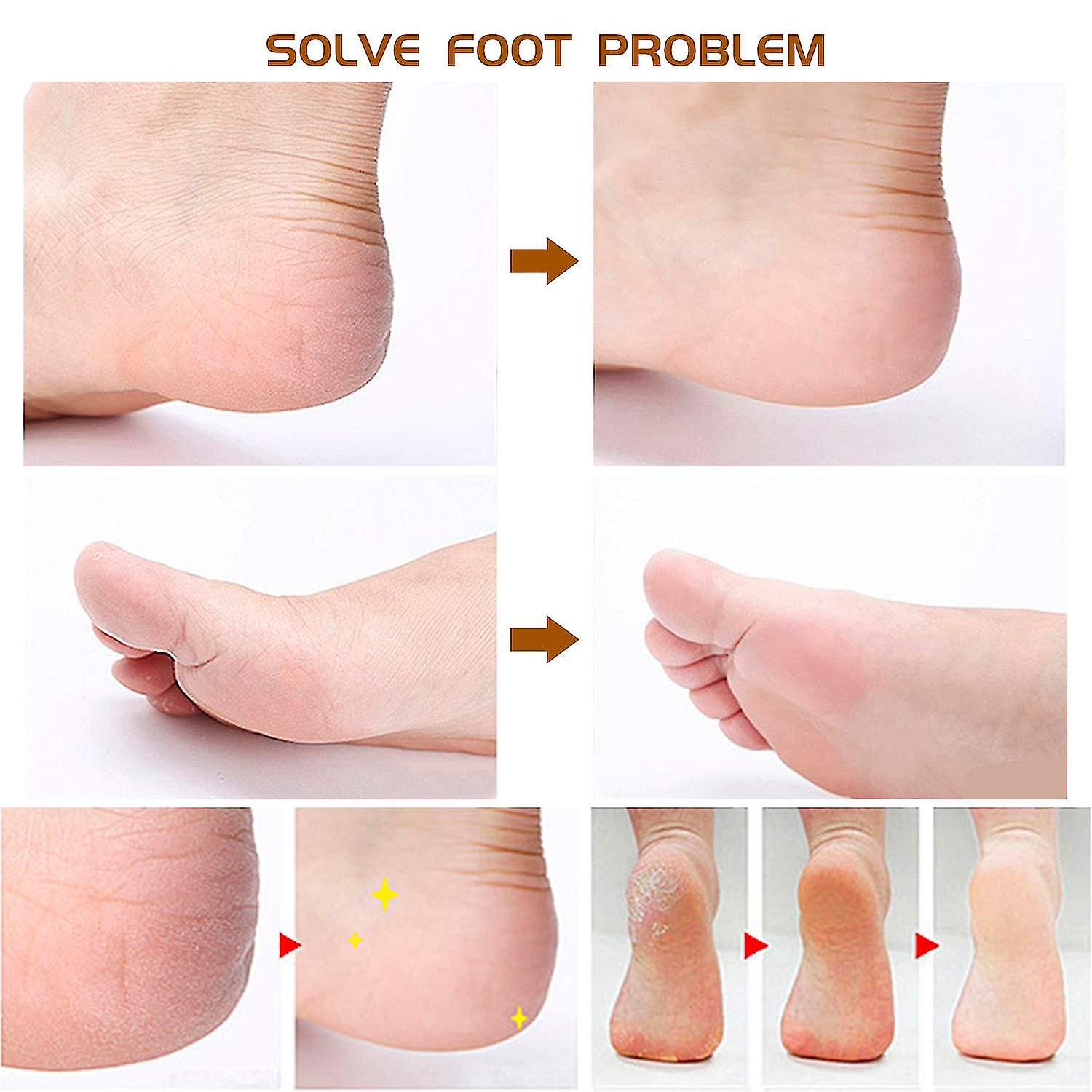 Kit pédicure 7 pièces en acier inoxydable pour soins des pieds féminins (colleur aléatoire) thumbnail 4