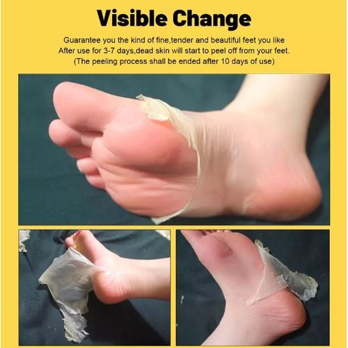 Masque Exfoliant “Banana Peel” à l’Arôme de Banane