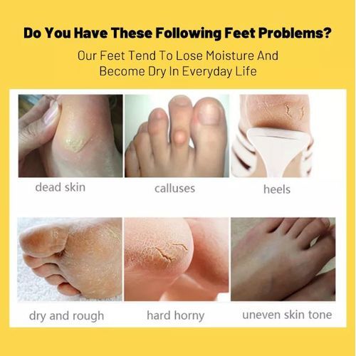 Masque Exfoliant “Banana Peel” à l’Arôme de Banane thumbnail 3