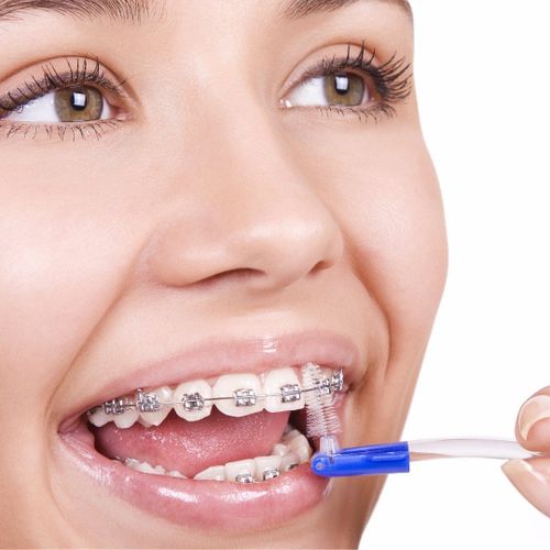 ORALEX 6 Brossettes Interdentaires pour une Bouche Saine