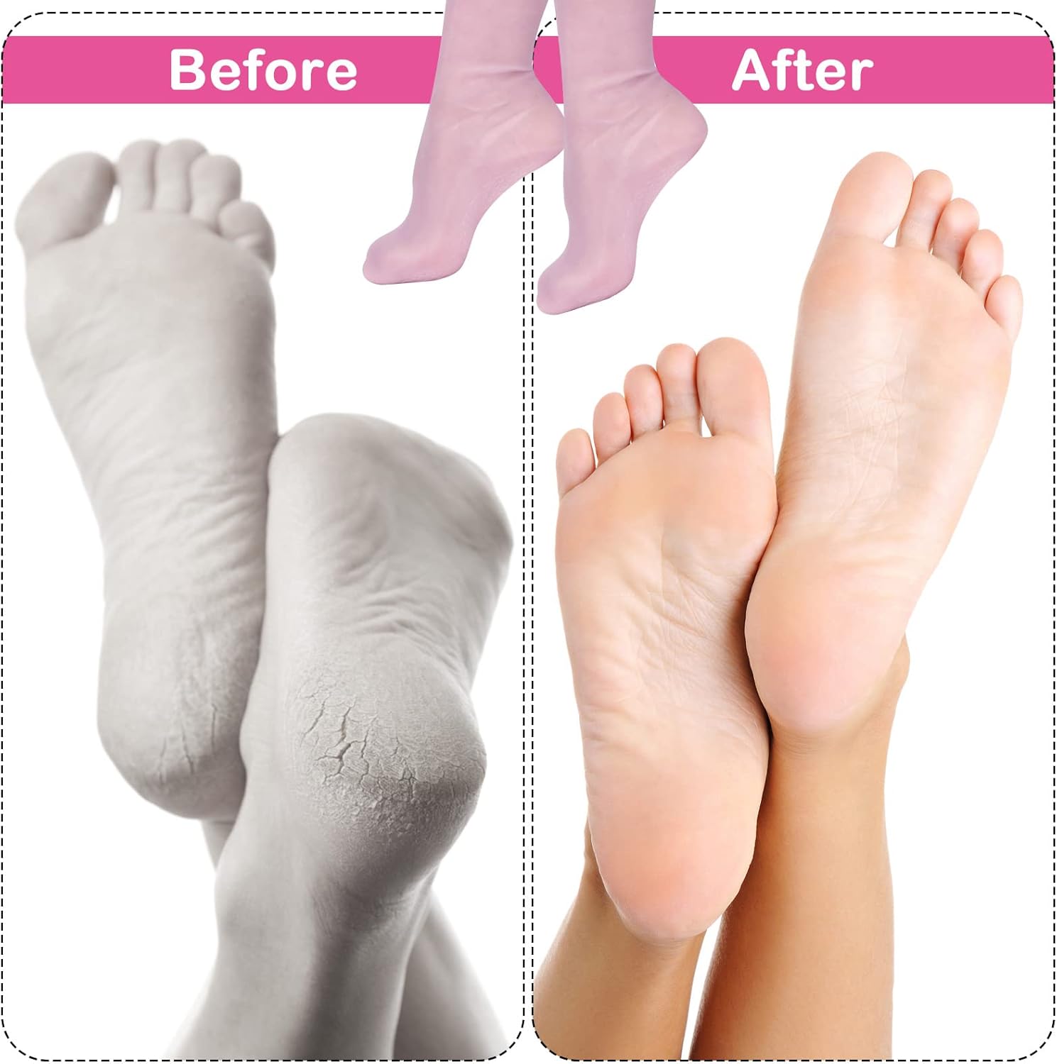 Lot De 2 Paires Chaussettes Hydratantes En Silicone thumbnail 4