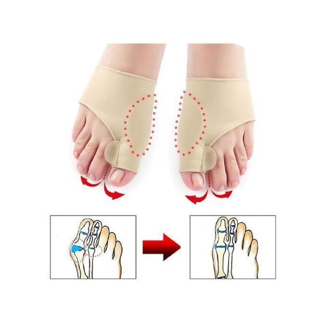 Correcteur Du Gros Orteil Soins Des Pieds, Soulagement De La Douleur thumbnail 1