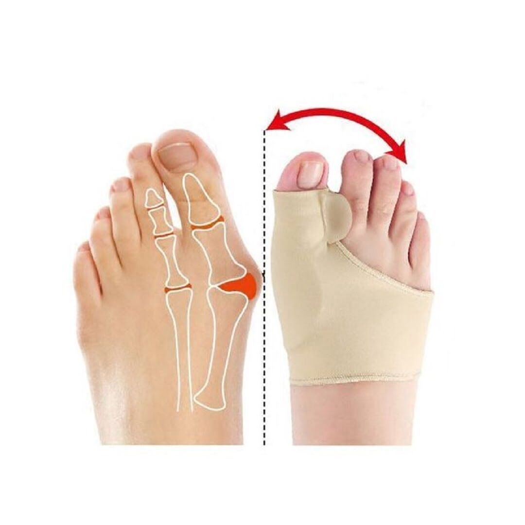 Correcteur Du Gros Orteil Soins Des Pieds, Soulagement De La Douleur thumbnail 3