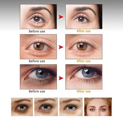 Sérum riche en vitamine E pour les yeux Anti-rides Anti-âge blanchissant éclaircissant les cernes 30ml