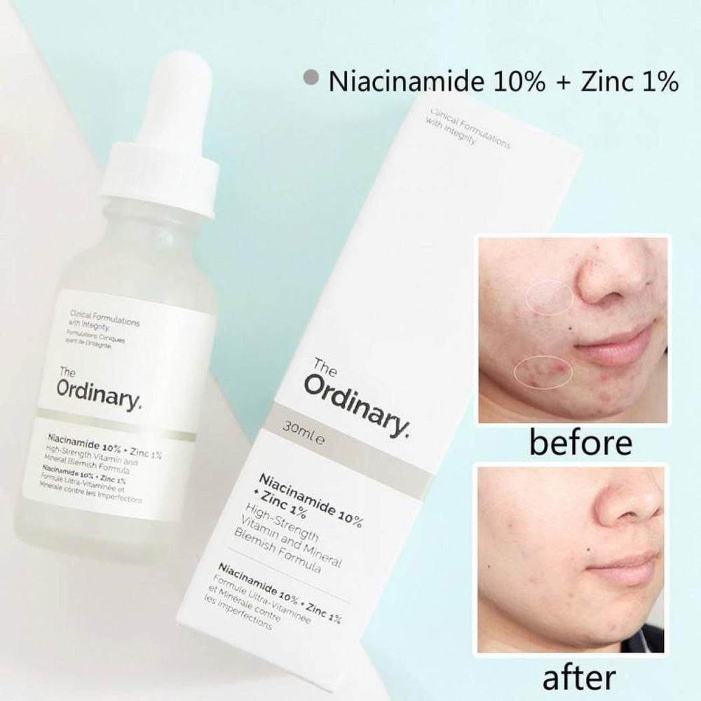 Niacinamide 10% + Zinc 1% 30ml thumbnail 2