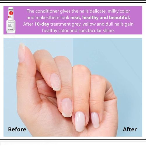 Thérapie Réparatrice 3in1 Sérum Durcisseur pour Ongles Fortifiant Contre les Décolorations