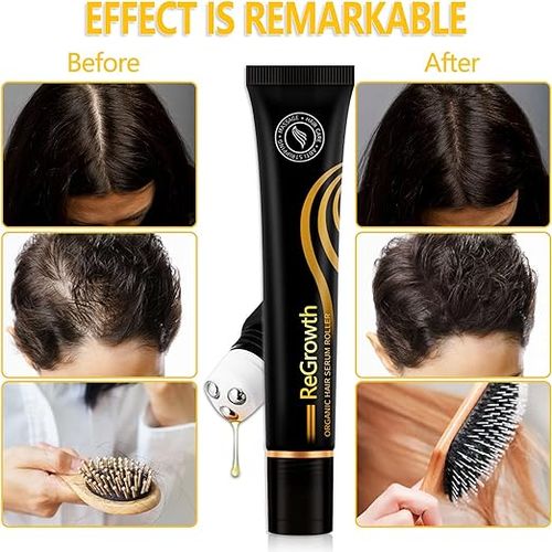 Huile Essentielle Pour La Croissance Des Cheveux