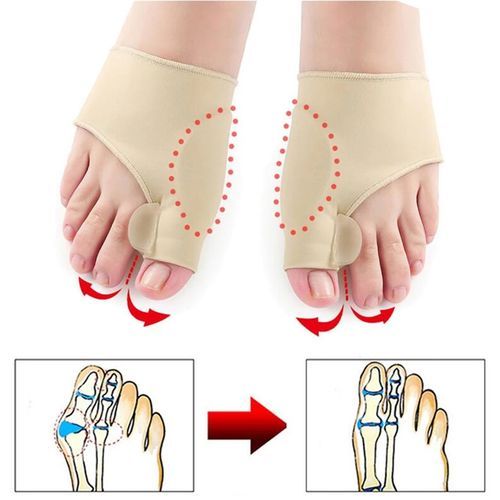 Correcteur D'oignon Et Attelle Orthopédique, Protecteur D'orteils En Gel, 1paire thumbnail 2