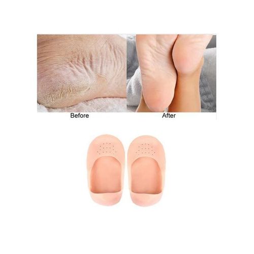 Chaussettes En Silicone Hydratantes - Anti-fissures, Soin Complet Des Pieds thumbnail 2