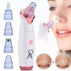 Nettoyeur Électrique De Points Noirs Et Acnés – Aspirateur De Pores Pour Soin Du Visage