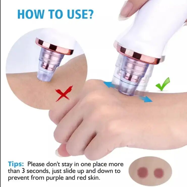 Nettoyeur Électrique De Points Noirs Et Acnés – Aspirateur De Pores Pour Soin Du Visage thumbnail 4