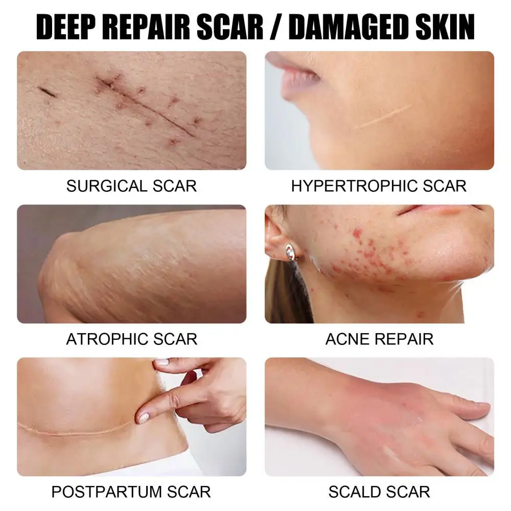 Crème Anti-cicatrices & Réduction Des Taches Pigmentaires thumbnail 3