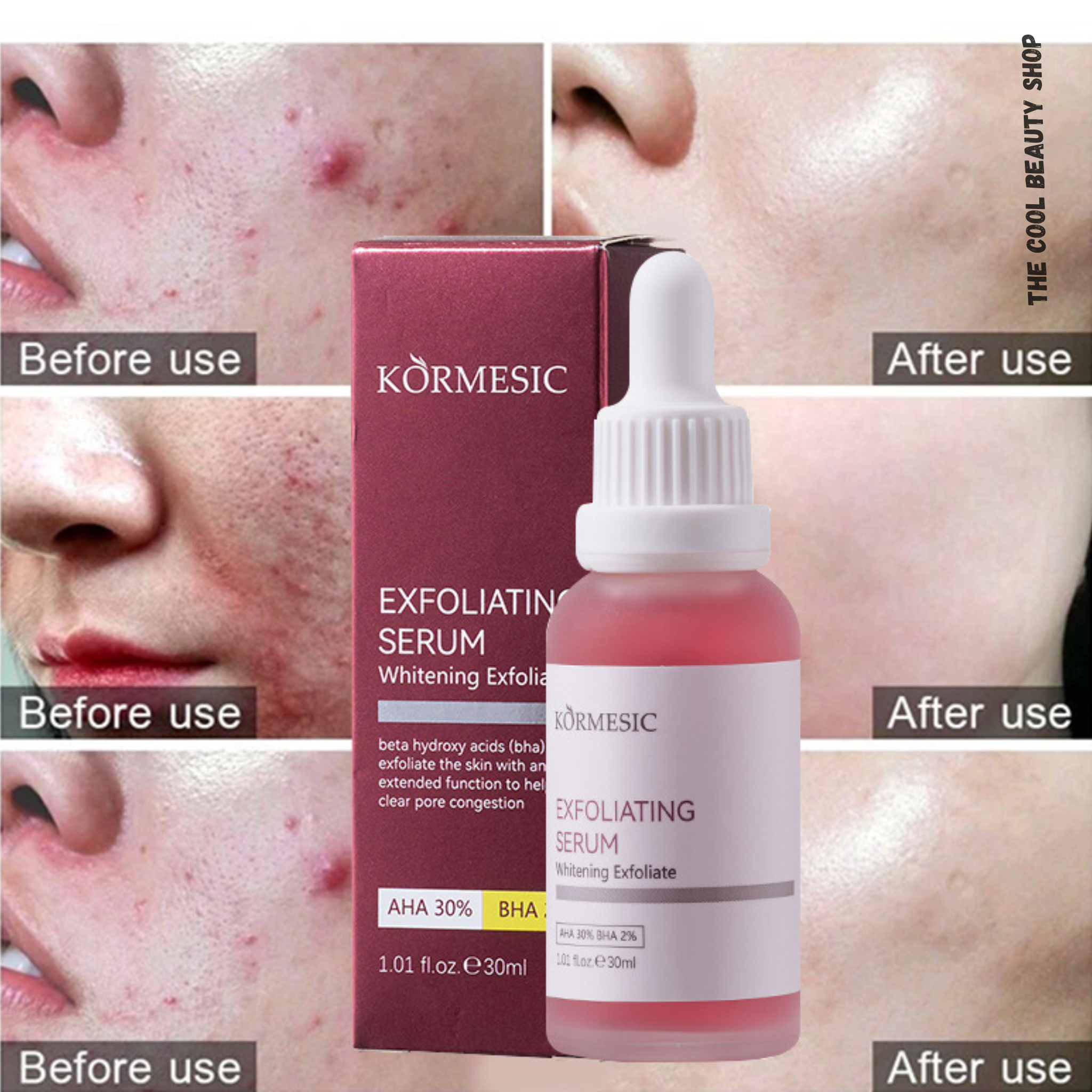 Sérum Exfoliant Aha 30% + Bha 2% – Peeling Visage Éclaircissant & Anti-imperfections