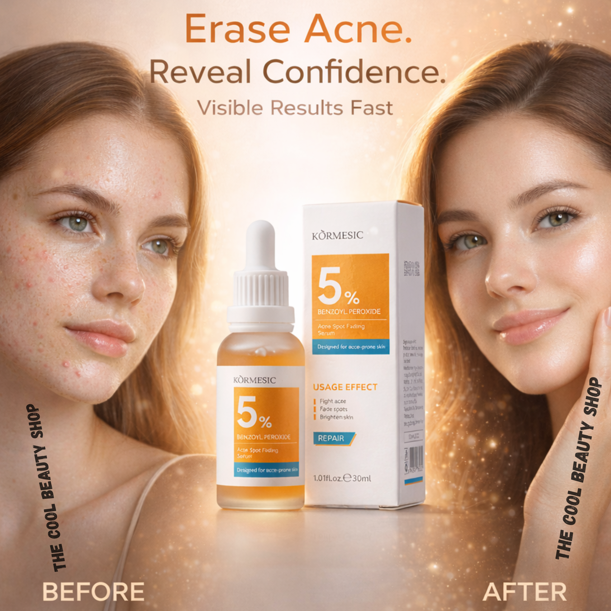 Sérum Anti-acné 5% Peroxyde De Benzoyle – Anti Boutons & Taches, Peau Nette