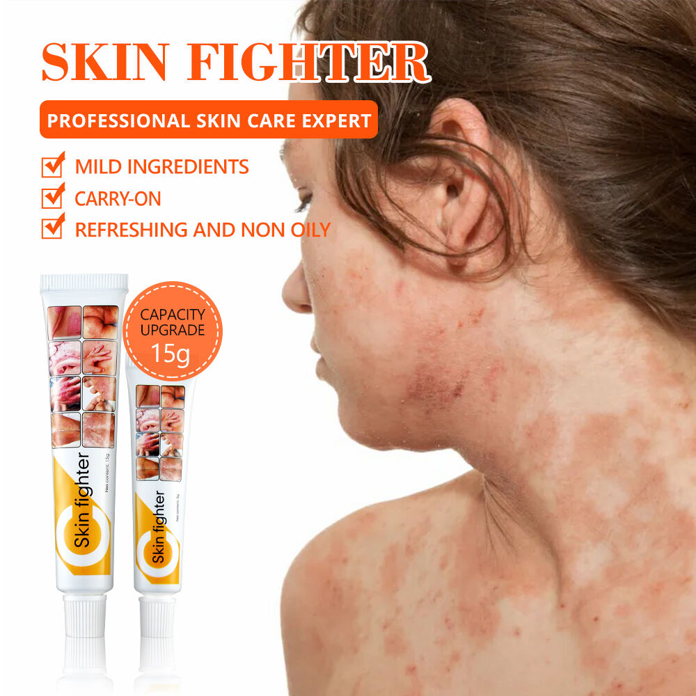 Crème Anti-démangeaisons & Anti-irritations – Eczéma, Rougeurs Et Mycoses thumbnail 3