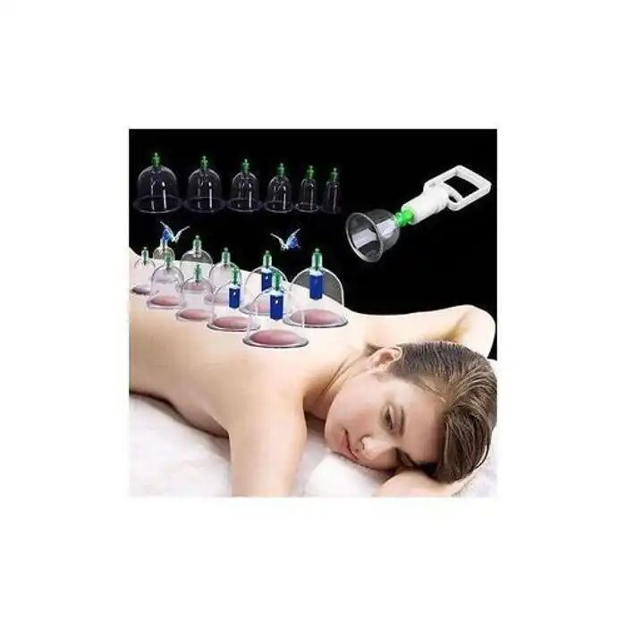Ventouses De Massage - Hijama - 6 Tasses + 1 Pompe - Thérapie Relaxation - Anti-cellulite - Mixte