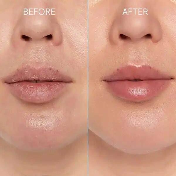 Baume À Lèvres Bio À L'huile De Coco