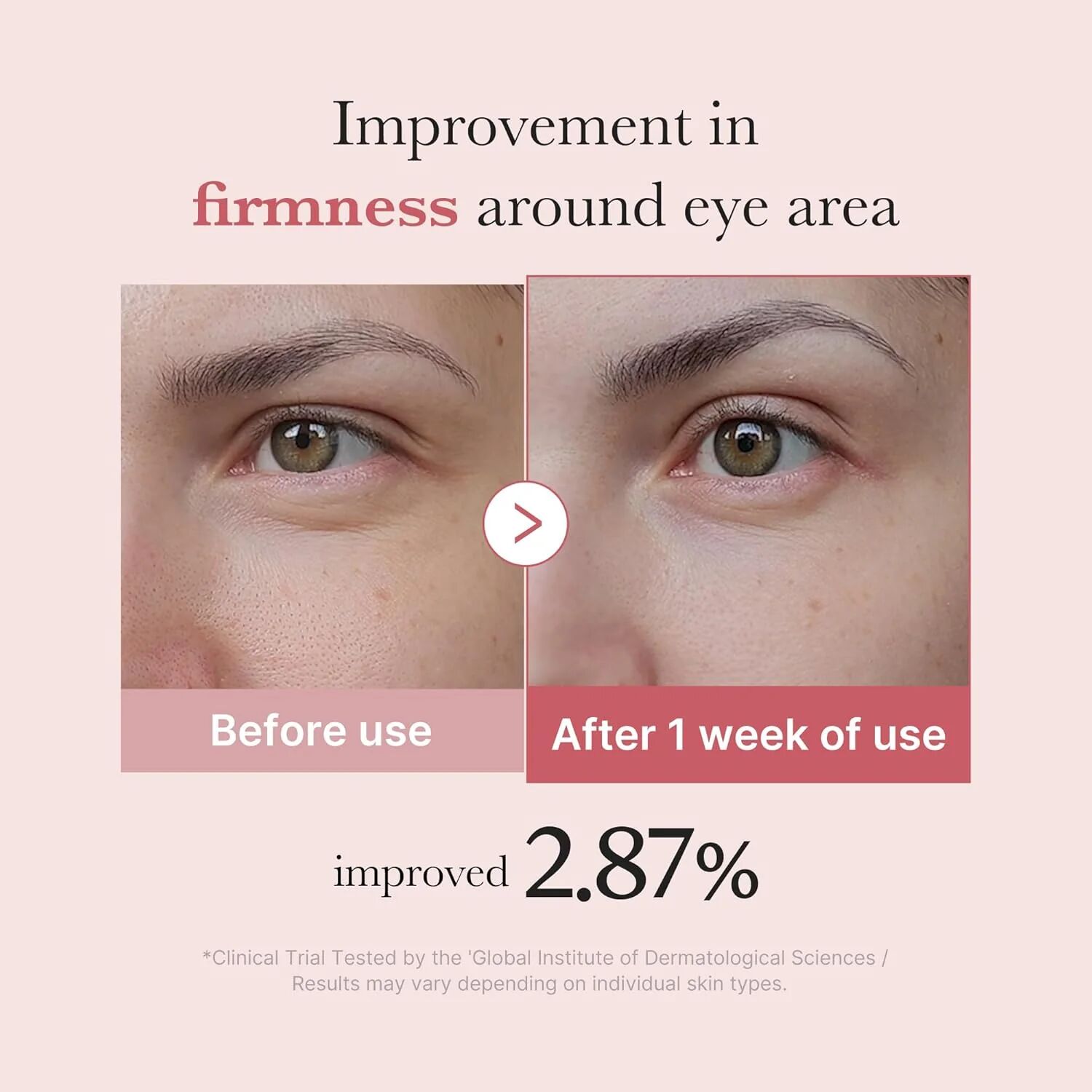 Pdrn Pink Peptide Eye Cream - 30ml thumbnail 3