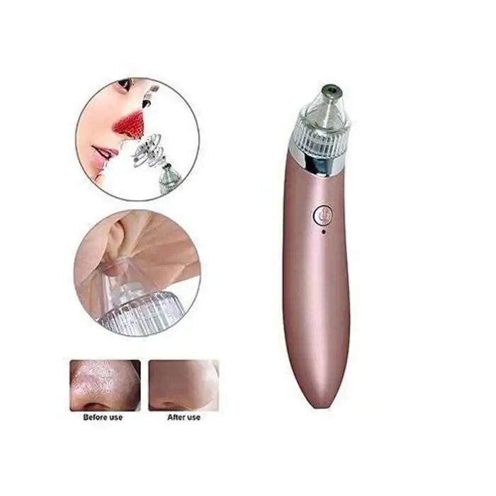 Aspirateur Visage - Anti-points Noirs - Minéral - 1 Appareil - Différentes Têtes - Adulte