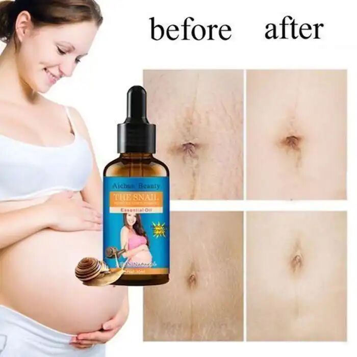 Huile Essentielle - Natural Snail - Élimine Les Vergetures - Réduit La Cellulite