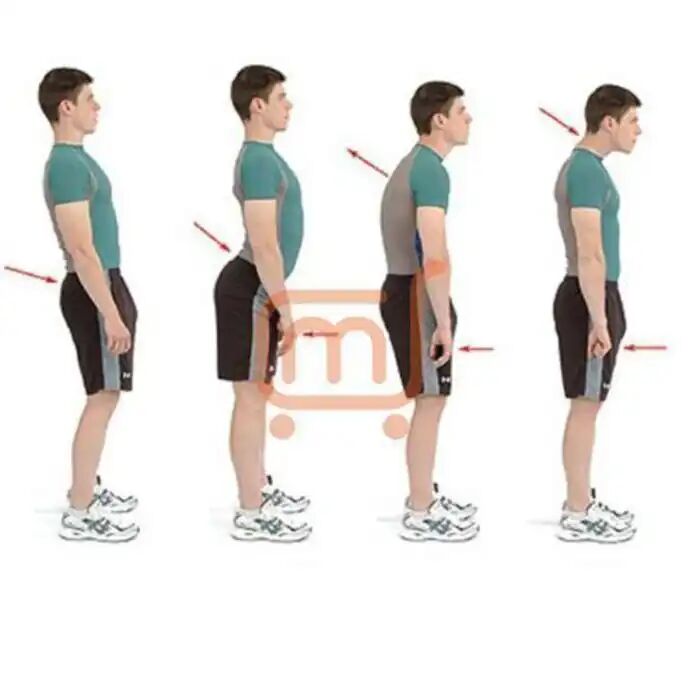 Correcteur De Posture - Ceinture Médicale thumbnail 3