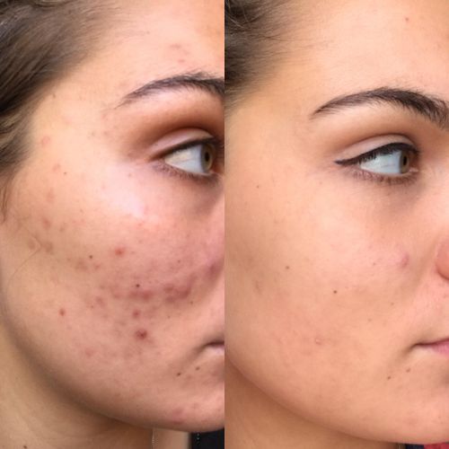 Vinci 3 In 1 Masque , Gommage , Crème De Nila Blue  thumbnail 3