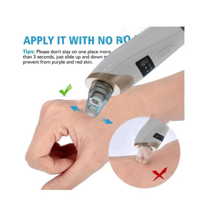 Aspirateur De Points Noirs Rechargeable thumbnail 2