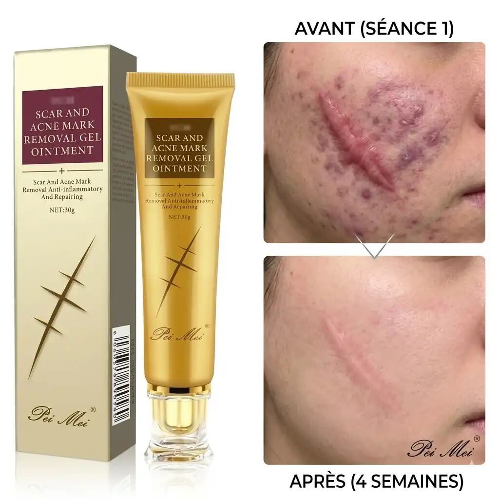 Crème Réparatrice De La Peau Anti - Cicatrices