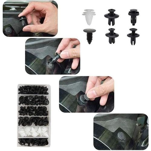 Kit De Clips De Retenue En Plastique Automobile – 415 Pièces