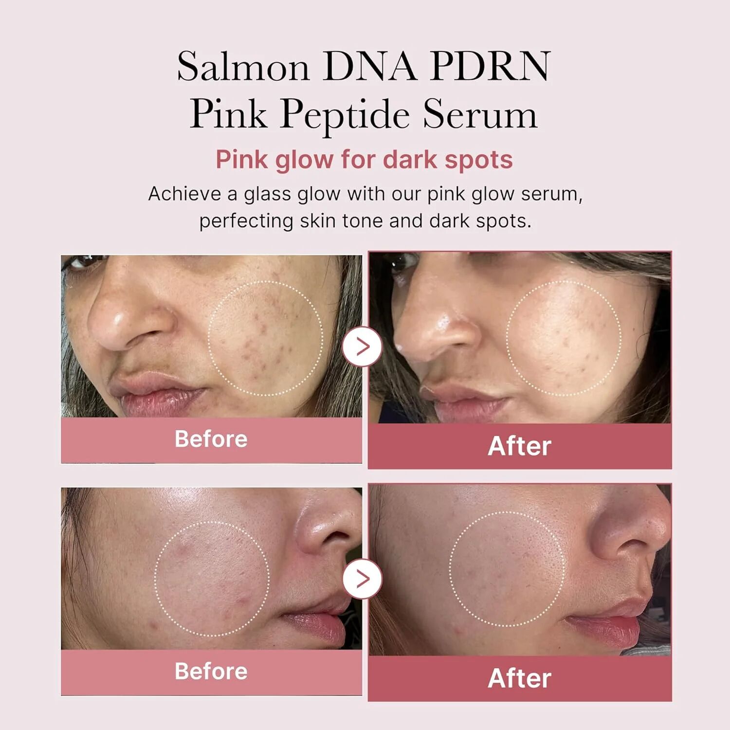 Pdrn Pink Peptide Serum - 30ml
