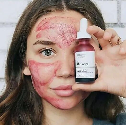 Peeling Solution Aha 30% + Bha 2%