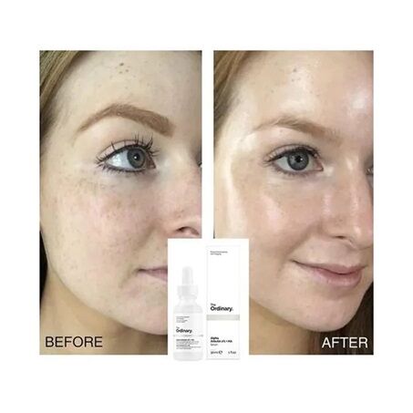 Sérum Anti-Taches, Alpha Arbutin 2% + Acide hyaluronique - 30ml thumbnail 3