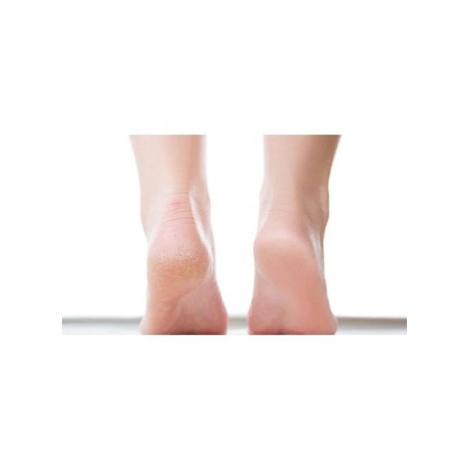 Exfoliating Socks, Chaussettes Exfoliante, Soin Anti Callosité thumbnail 4