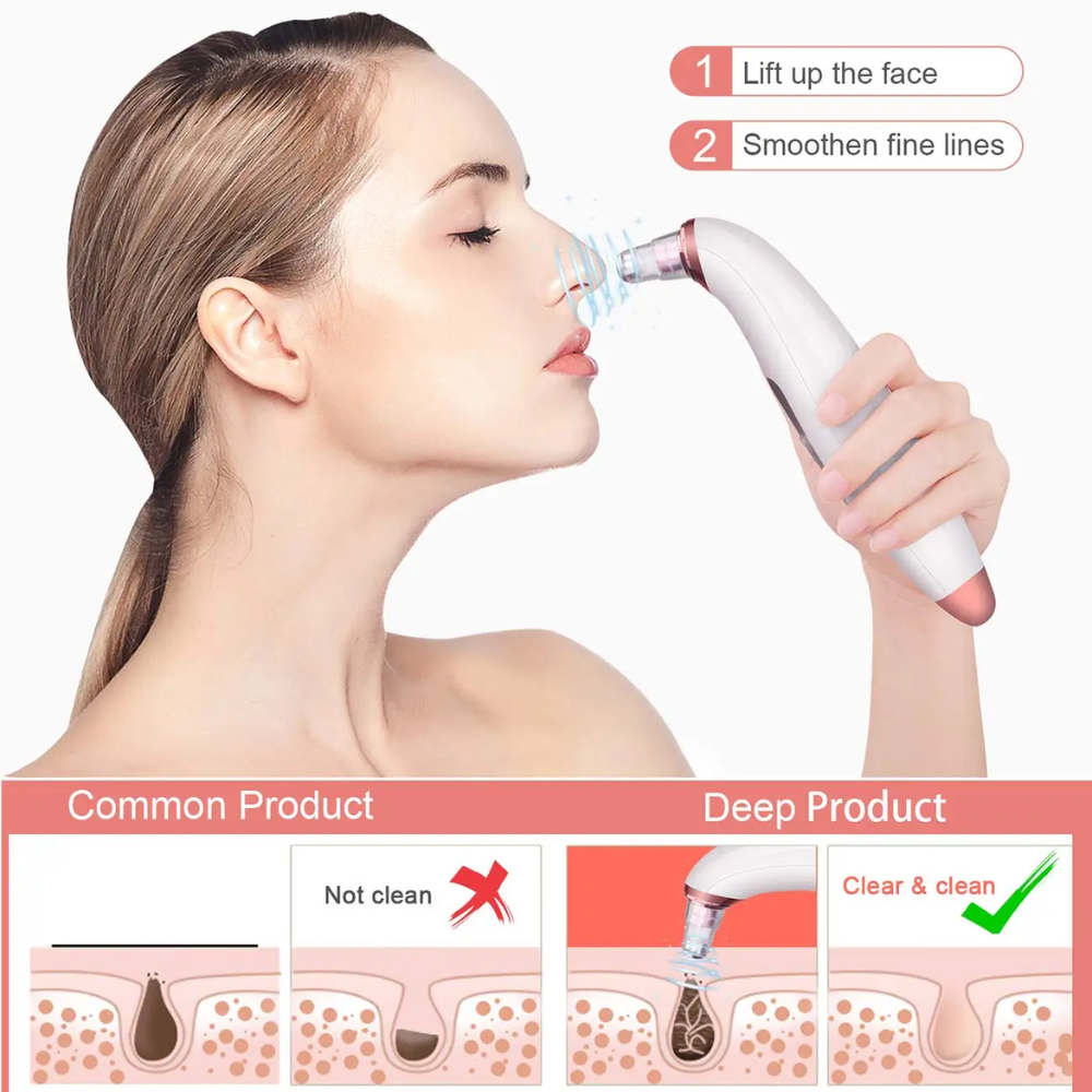 Aspirateur De Pores Pour Points Noirs – Avec Caméra Et 3 Embouts thumbnail 3