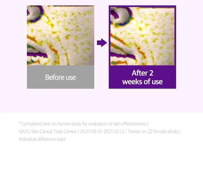 Rétinol Kit d’essai Intense - Eye Cream & Sérum  thumbnail 3