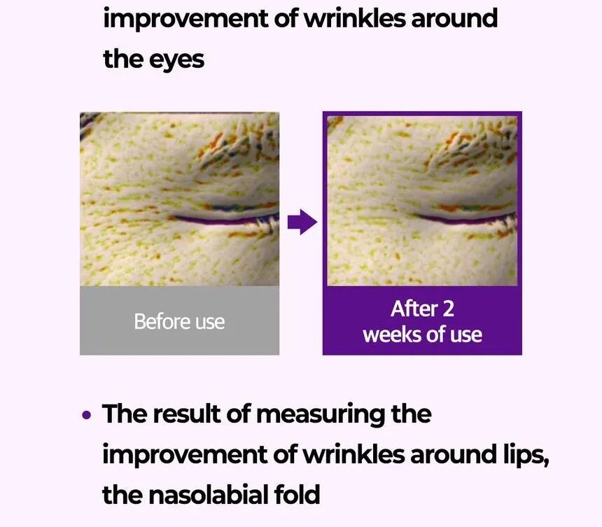 Rétinol Kit d’essai Intense - Eye Cream & Sérum  thumbnail 4