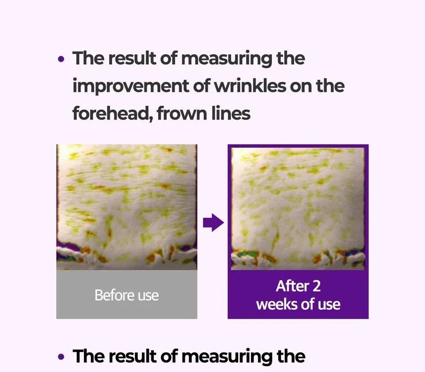 Rétinol Kit d’essai Intense - Eye Cream & Sérum  thumbnail 5