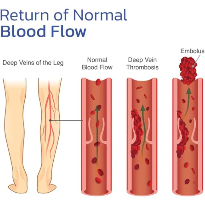 Tapis de massage des pieds, masseur bioélectrique d'acupuncture thumbnail 6