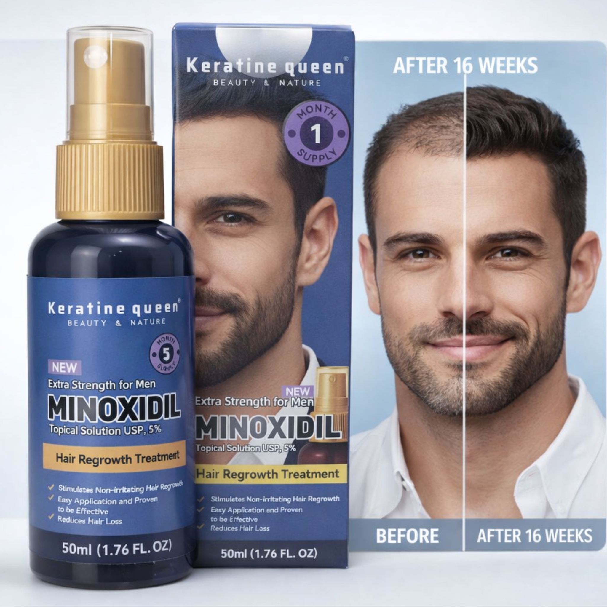 Minoxidil 5% Extra Strength Pour Homme – Solution Topique 50ml